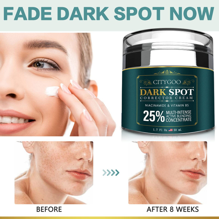 CITYGOO Dark Spot Remover for Face Dark Spot Corrector Cream - Enriching Skin Care For All Skin
