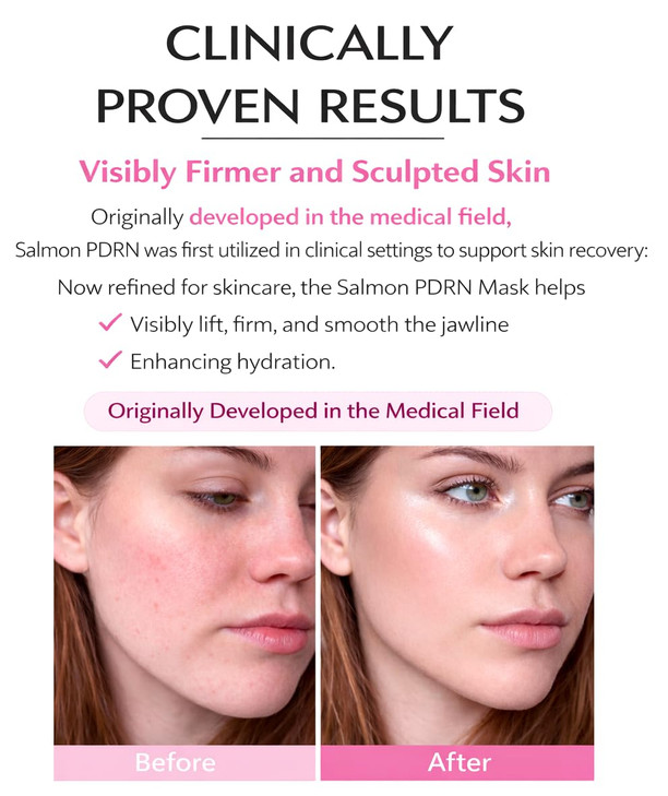 LumiVida 5 Pack Salmon DNA Collagen Mask 99 PDRN Anti-Aging Gel Mask Overnight Firming & Hydrating Face Mask for