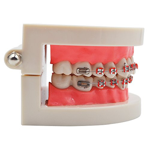 Standard Tooth Teaching Mallocclusion Orthodontic Teeth Model with Brackets Archwire Buccal Tube Tool