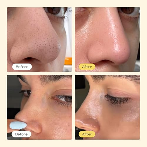 Luelle - Pore Strips, Deep Cleansing Patch System, Blackhead Remover, Nose Plants Strips with 100 PCS, Blackhead
