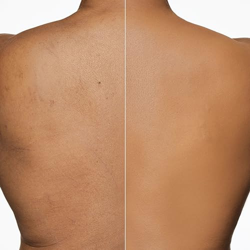 Dermablend Leg & Body Makeup Foundation SPF 25, 45W, 3.4 fl oz