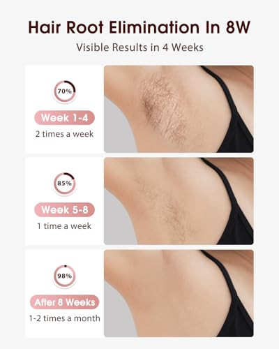 LYSMOSKI Laser Hair Removal, IPL Hair Removal with Ice-Cooling System for Painless & Long-Lasting Result, Safe At-Home