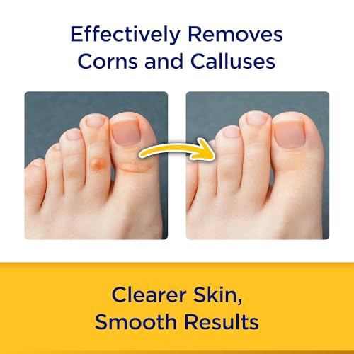Cornstick Corn And Callus Remover 0.2 Oz