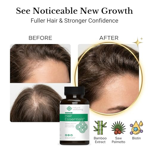 Natural Wellbeing Hair Essentials Dht Blocker Hair Growth Supplement For Women And Men Saw Palmetto Biotin Vegan Capsules Stops Shedding And