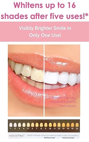 Novashine Professional Teeth Whitening Kit Advanced Blue Led Light Concentrated Peroxide Gel Smartphone Adapter Travel Bag