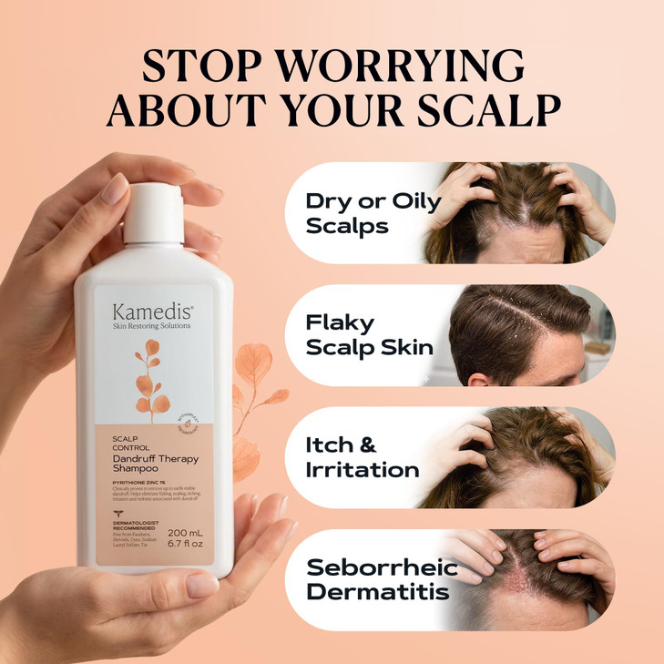 Kamedis Scalp Savior Itchy Dry Scalp Treatment And Seborrheic Dermatitis Relief. Gentle Sls Free Formula. 6.7 Fl Oz