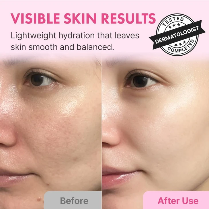 Hanskin Hyaluron Skin Essence Hyaluronic Acid Toner Dry Skin 5.07 Fl Oz