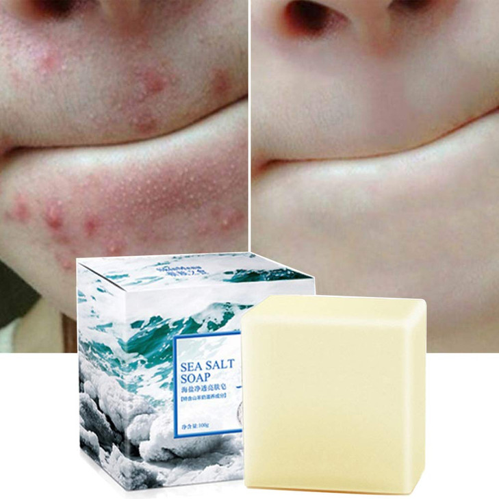 Soap With Sea Salt Natural Goat S Milk For Face Dry And Natural Oily Skin Remove Acne Anti Cellulite Soap 3.52 Oz