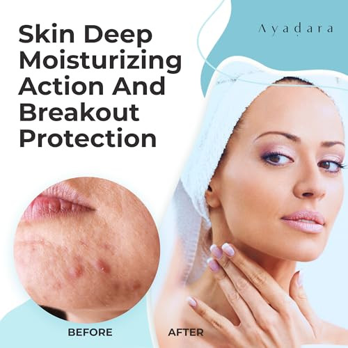 Moisturizing Acne Cream Salicylic Acid Face Moisturizer For Oily And Acne Prone Skin Helps With Pimples Blackheads Whiteheads Hormonal And