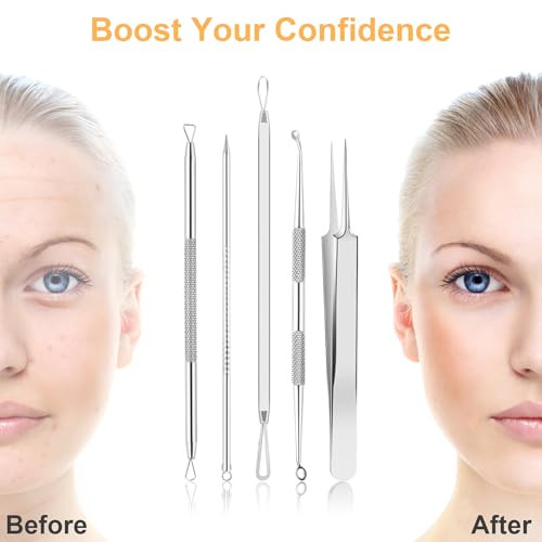 9 Pcs Blackhead Remover Tools Pimple Popper Tool Kit Pimple Extractor