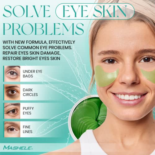 Mashele Korean 60Pcs Aloe Vera Collagen Under Eye Gel Patches Mask Treatment For Puffy Eyes Dark Circles Anti Wrinkle Pads Moisturizing For