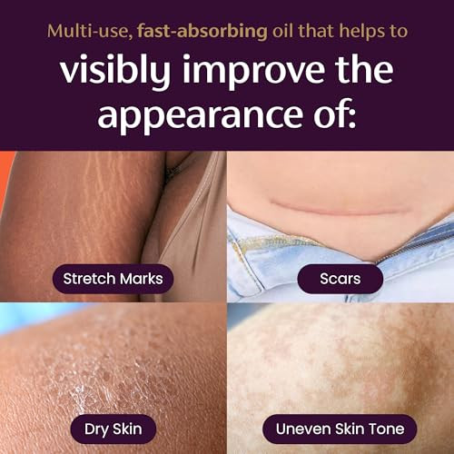 Mederma Quick Dry Oil Scar And Stretch Mark Treatment Improves Appearance With Natural Botanical Extracts Paraben Free Fast Absorbing