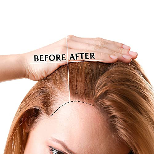 Luv Me Care Biotin Hair Growth Oil Hair Growth Serum For Thicker Longer Fuller Healthier Hair Prevent Hair Loss And Thinning All Natural