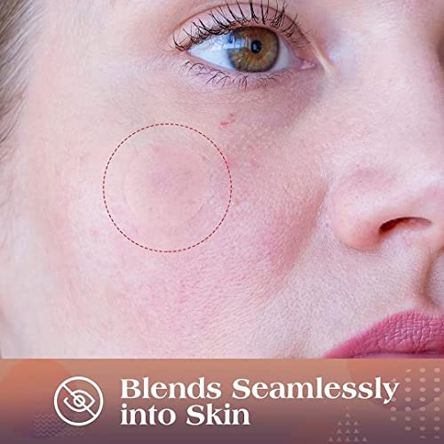 Auslka Blemishes Patches 175 Patches Hydrocolloid Spot Dots Blemishes Patch Pimple Stickers For Face Absorbing Cover Patch