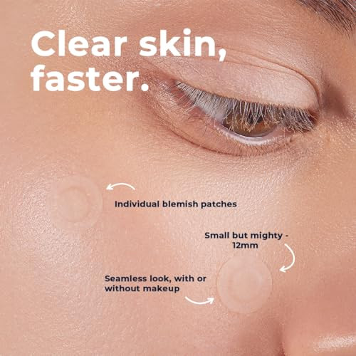 Vitamedica Clear Skin Spot Dots Hydrocolloid Acne Patches 24 Count