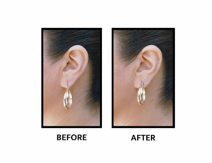 Lobe Wonder - The ORIGINAL Ear Lobe Support Patch for Pierced Ears - Eliminates the Look of Torn or Stretched Piercings - Protects Healthy Ear Lobes