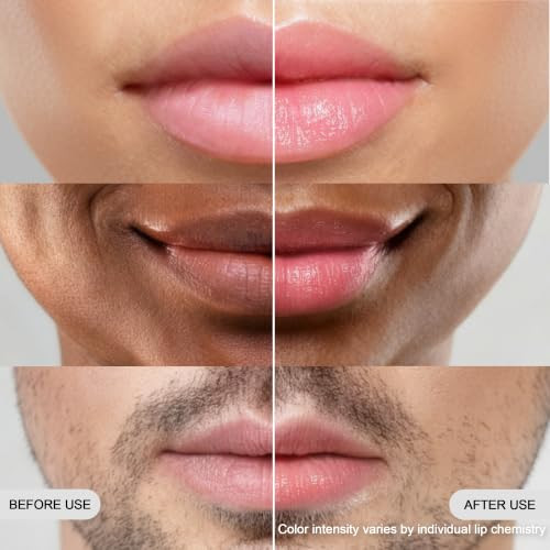 Moon Lip Ph Lip Balm For Men And Women