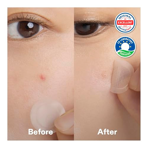 Cordiale Niacinamide Microdart Pimple Patches Acne Spot Patch 12 Count