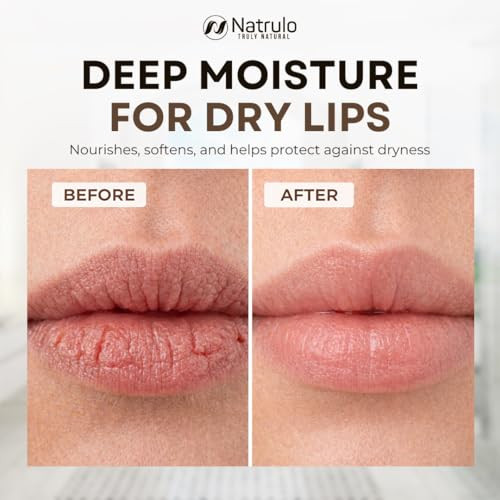 Shea Butter Lip Balm Moisturizing Coconut Chapstick For Dry Cracked Lips