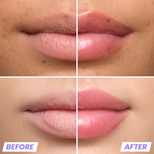 Wonderskin Lip Plumper Gloss Lip Relapse High Shine And Plumping Gloss