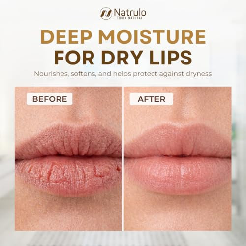 Coconut Lip Balm Moisturizing Coconut Oil Chapstick For Dry Cracked Lips