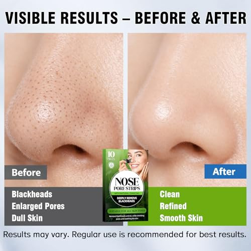 Shaeva Natural Charcoal Pore Strips Blackhead Remover Strip For Oily Skin Strawberry Nose Deep Clean And Shrinking Pores And Smoothing Skin