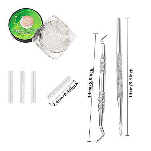 30 Plus 2 Pack Ingrown Toenail Correction Treatment Kit 30Pcs Ingrown Toenails Corrector Strips Brace Ingrown Toenail Pedicure Tool Toenail