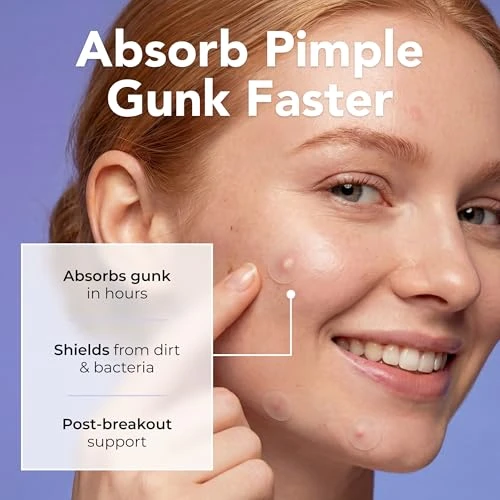 Pimple Patches With Retinol Hydrocolloid Acne Stickers With Tea Tree Oil For Face Blemish Dots 120 Count