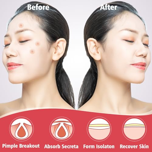 450 Pimple Patches For Face Hydrocolloid Acne Patches For Zit Covers