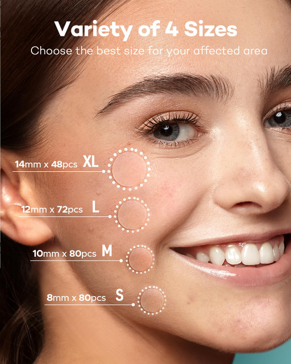TKTK Pimple Patch Acne Patch, 4 Sizes 280 Patches Acne Absorbing Cover Patch, Hydrocolloid Invisible Acne Patches For Face Zit Patch Acne Dots Tea Tr