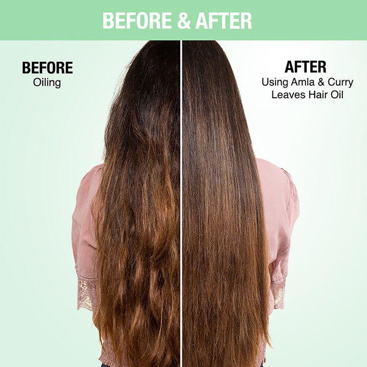Nykaa Naturals Hair Oil - Amla and Curry for Women - 6.76 oz Oil