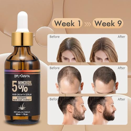 5% Minoxidil Hair Growth Treatment for Men and Women - Biotin Serum to Prevent Hair Loss and Thinning (2 Pack)