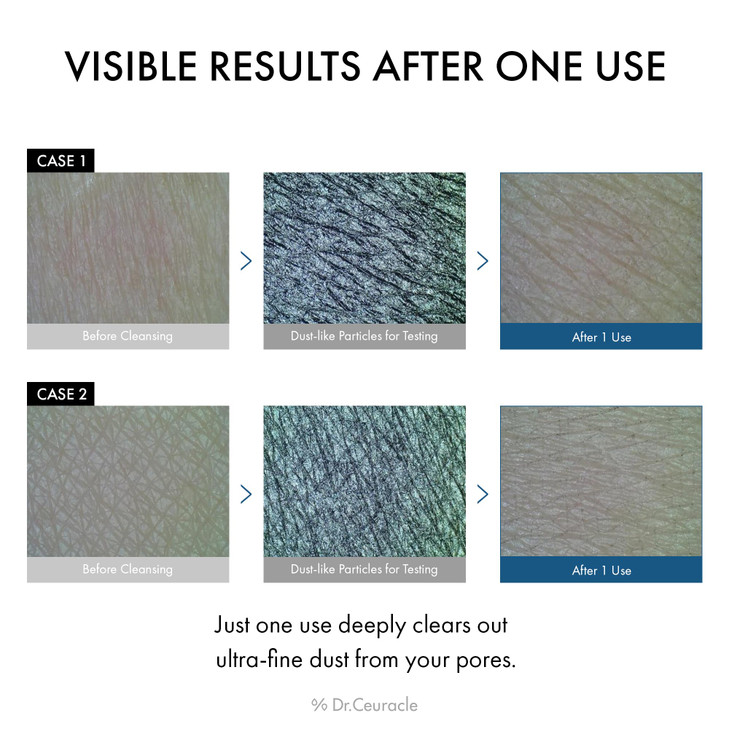 Dr.Ceuracle Pro Balance Enzyme Powder Face Wash - Korean Day and Night Natural Enzyme Powder Face Wash for Deep Pore Cleansing, Sebum Removing, pH Sk