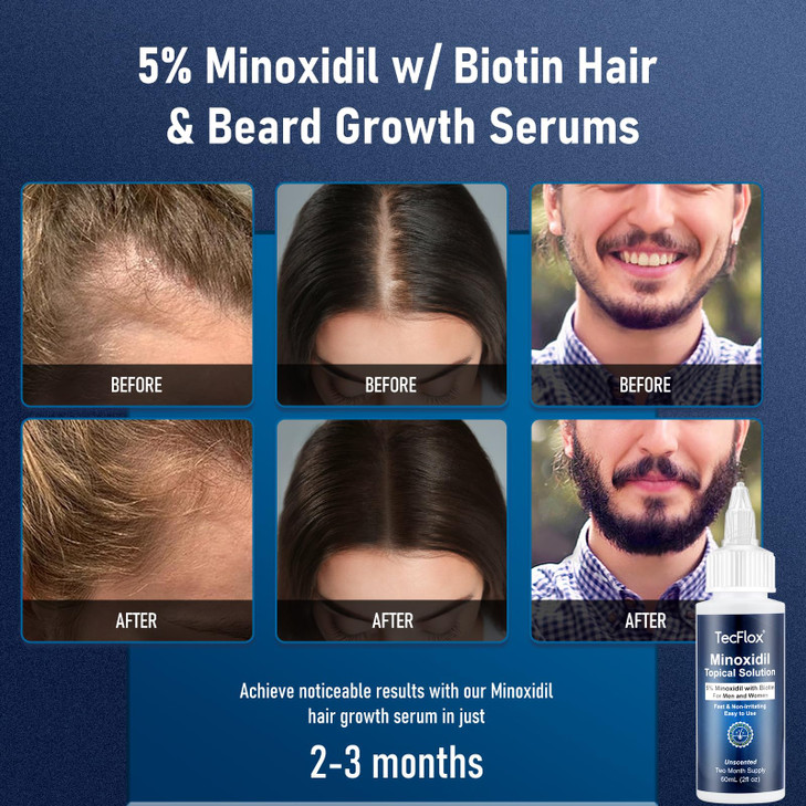 TecFlox 5% Minoxidil with Biotin for Men & Women, Beard Growth Oil, Hair Growth Serum, Unisex, 2-Pack, Total 4 fl oz for 4 Months