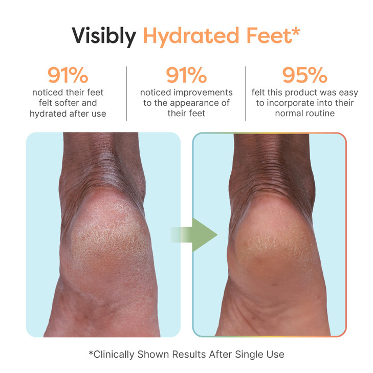 ZenToes Moisturizing Foot Mask for Dry Cracked Feet | Shea Butter, Jojoba Oil & Squalane Infused Hydrating Sheet Masks | Spa Experience At Home | Mes