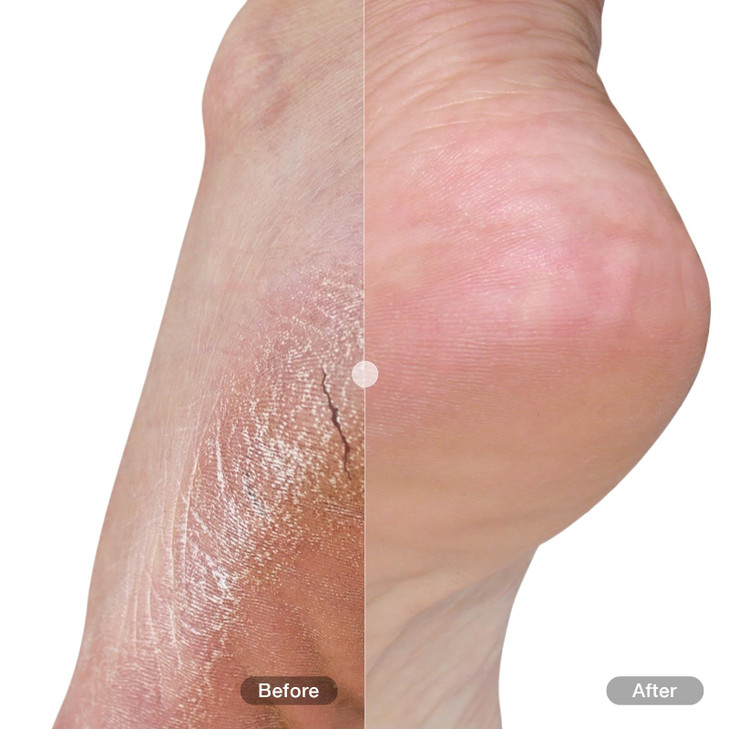 Du'it Foot & Heel Balm Plus 50ml