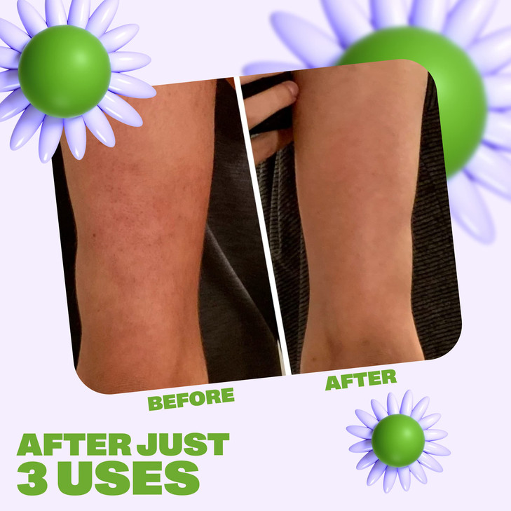 Becky | Natural Walnut Scrub + Exfoliator for Smooth Skin  Reduces Cellulite, Stretch Marks, Bikini Bumps, and Dry Skin | For Butt, Thighs, Legs, an