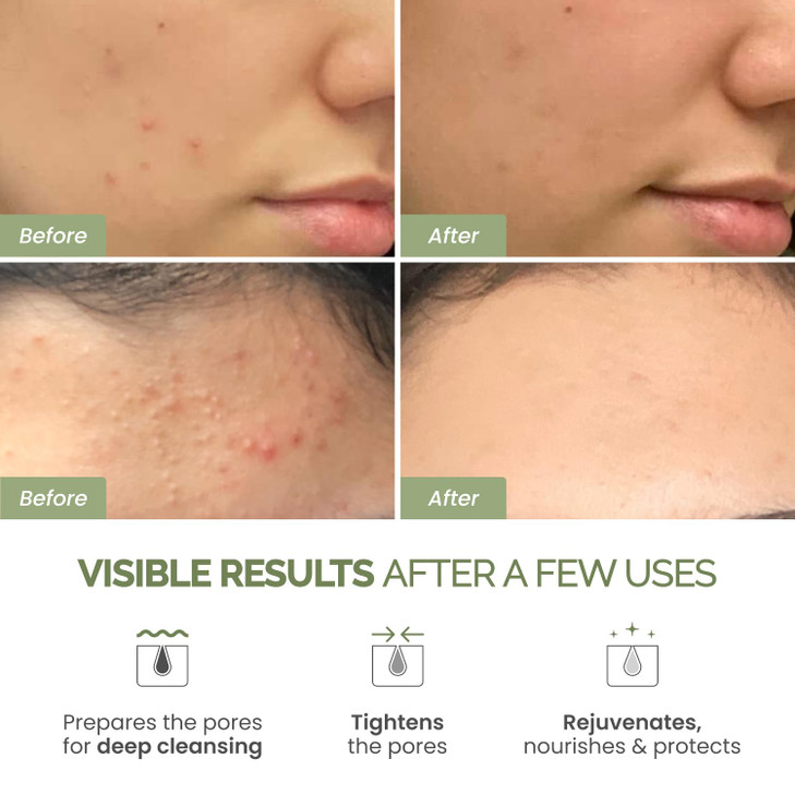 PLANTIFIQUE Korean Skincare Clay Mask  Hydrating Mud Mask with Avocado & Superfoods, Dermatologist-Tested for Face & Body  Vegan, 3.4 Oz/100ml