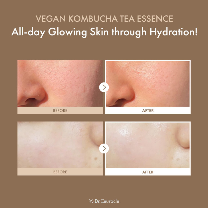 Dr.Ceuracle Vegan Kombucha Tea Essence - Hydrating Milky Toner with Kombucha Tea Extract, Centella Asiatica, Ceramide, Korean Skincare Essence (150 m