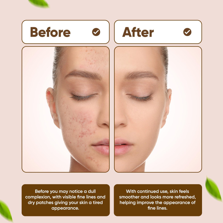 Dinur Cosmetics Bio Clean Drying Lotion .68 fl. oz. 20 ml