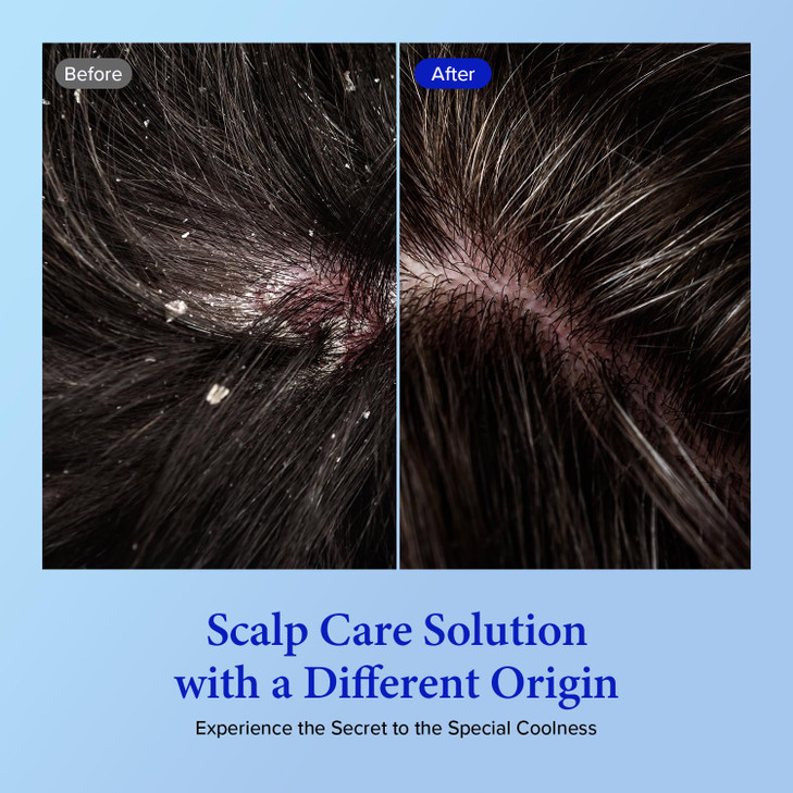 Kundal Shampoo, Hair Scalp Care - Aqua Mint Refreshing Cool Shampoo with Eucalyptus, Tea Tree Extracts, Argan Oil 10.14 fl.oz, Pack of 2