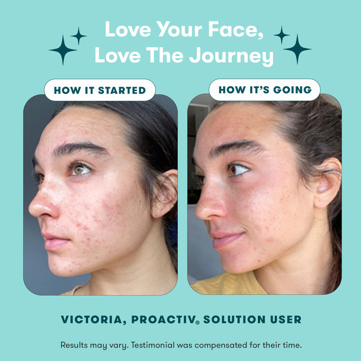 Proactiv 3 Step Acne Treatment - Benzoyl Peroxide Face Wash, Repairing Acne Spot Treatment for Face and Body, Exfoliating Toner - 30 Day Complete Acn