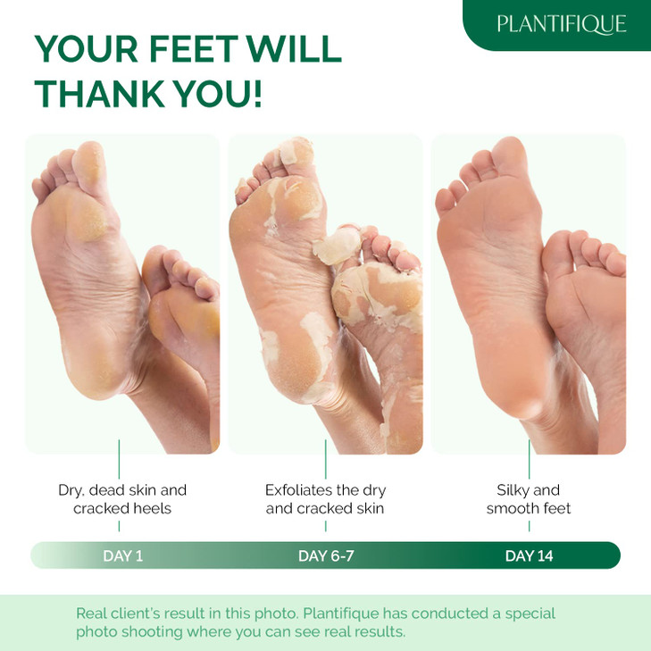 PLANTIFIQUE Foot Peeling Mask 4 Pack | Dermatologically Tested Repairs Heels & Removes Dry Dead Skin for Baby Soft Feet | Exfoliating Foot Peel Mask