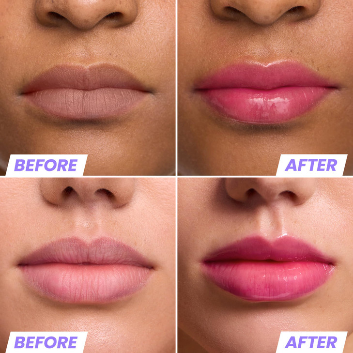 Wonderskin Lip Oil Rehab Serum - Color Changing Lip Oil from Clear to Pink - PH-activated, Non-sticky & Hydrating Tinted Serum for Dry Lips (Kissed)