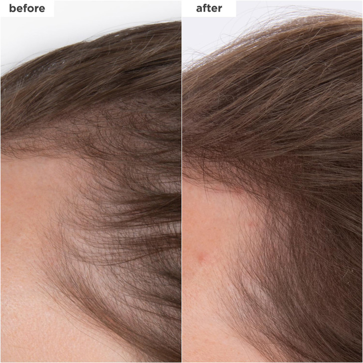 Briogeo Destined For Density MegaStrength+ Caffeine + Biotin Peptide Density Serum, Increases Hair Thickness and Volume, Fast-Absorbing & Non-Greasy,