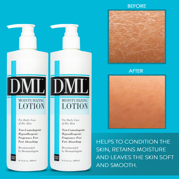 DML Moisturizing Lotion- Hydrating Hand and Body Moisturizer / Hypoallergenic Body Lotion for Dry and Cracked Skin / Gentle, Unscented Moisturizing L