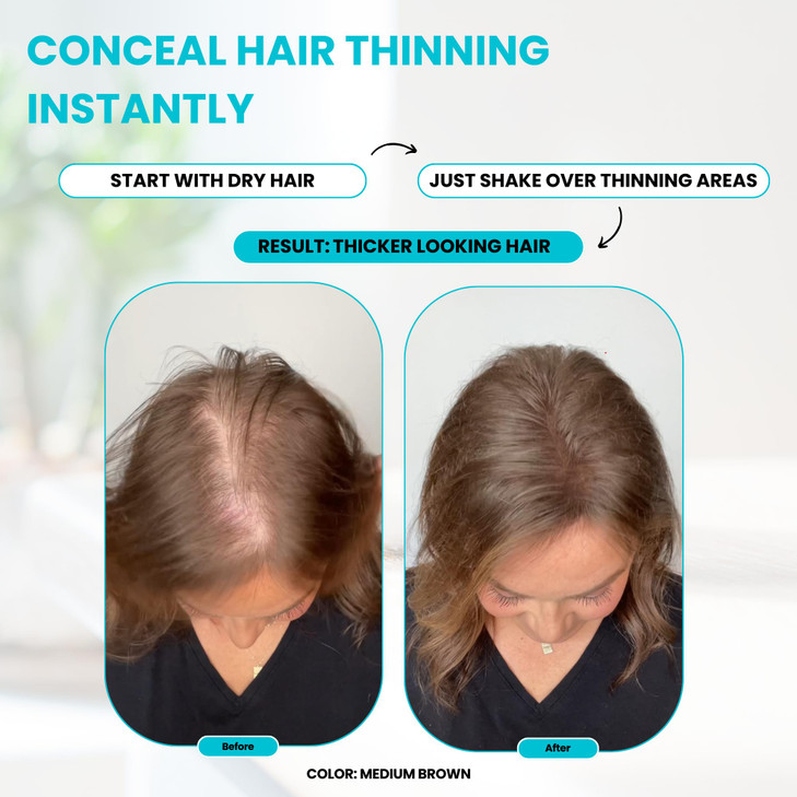 SURETHIK Hair Fibers, 30g (Dark Brown), Fills Thinning Hair for Visibly Fuller Look, Conceals Bald Spots, Natural Look, For Men & Women