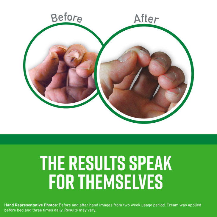 O'Keeffe's K0680001-3 Working Hands Hand Cream in Jar (3 Pack), 6.8 oz