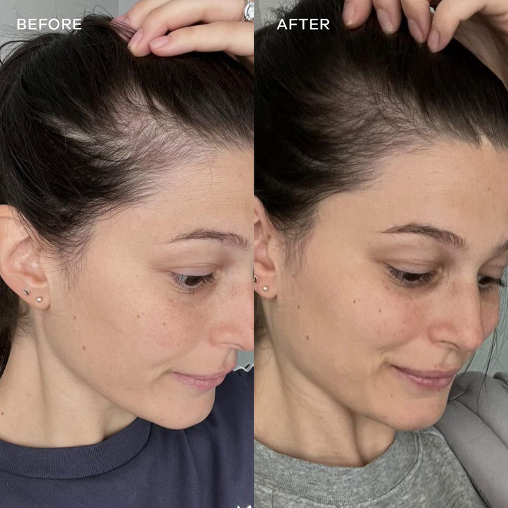 Vida Glow Marine Collagen Powder - Anti Aging Supplement with Collagen Peptides, Promotes Glowing Skin, Strong Nails, Healthy Hair | 30 Servings, Man