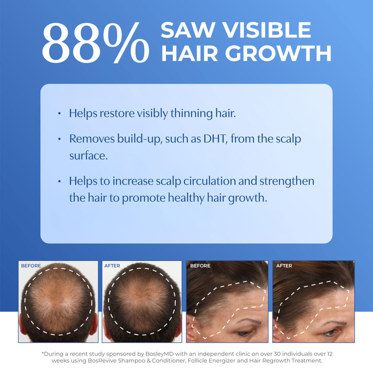 BosRevive Nourishing Shampoo for Noticeably Thinning, Non Color-Treated Hair  Helps Restore Thinning Hair & Remove DHT, Product & Pollution Build-Up